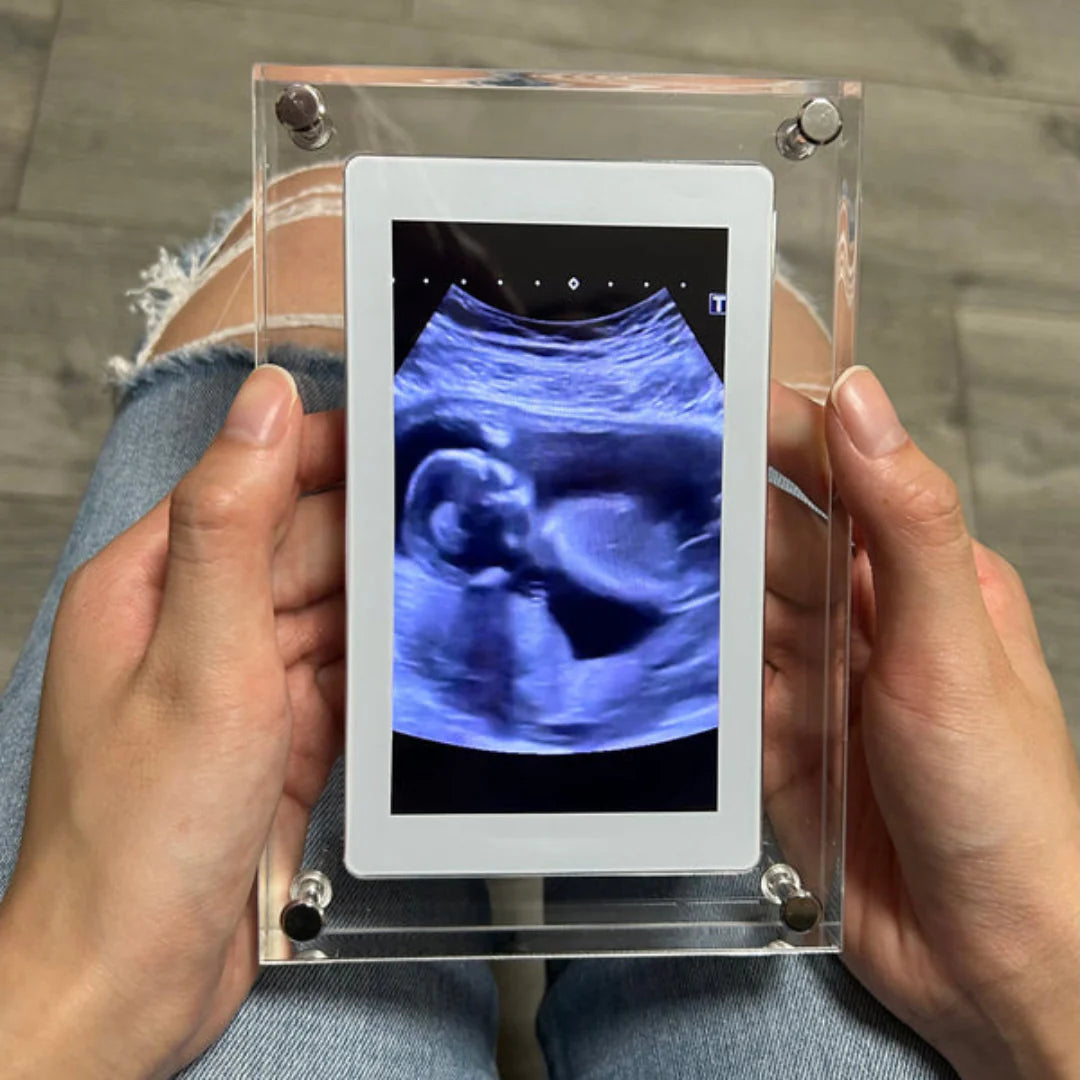 Quadro Digital - Momentos inesquecíveis são aqueles que ficam marcados no coração
